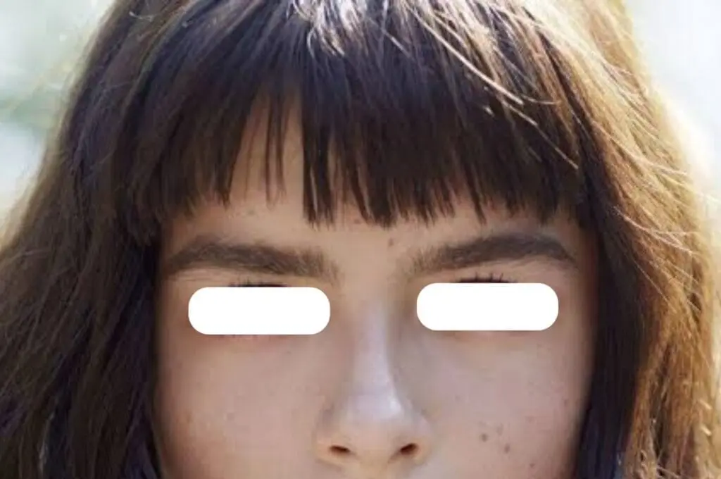 Cara Mengatasi Rambut Poni Gampang Lepek