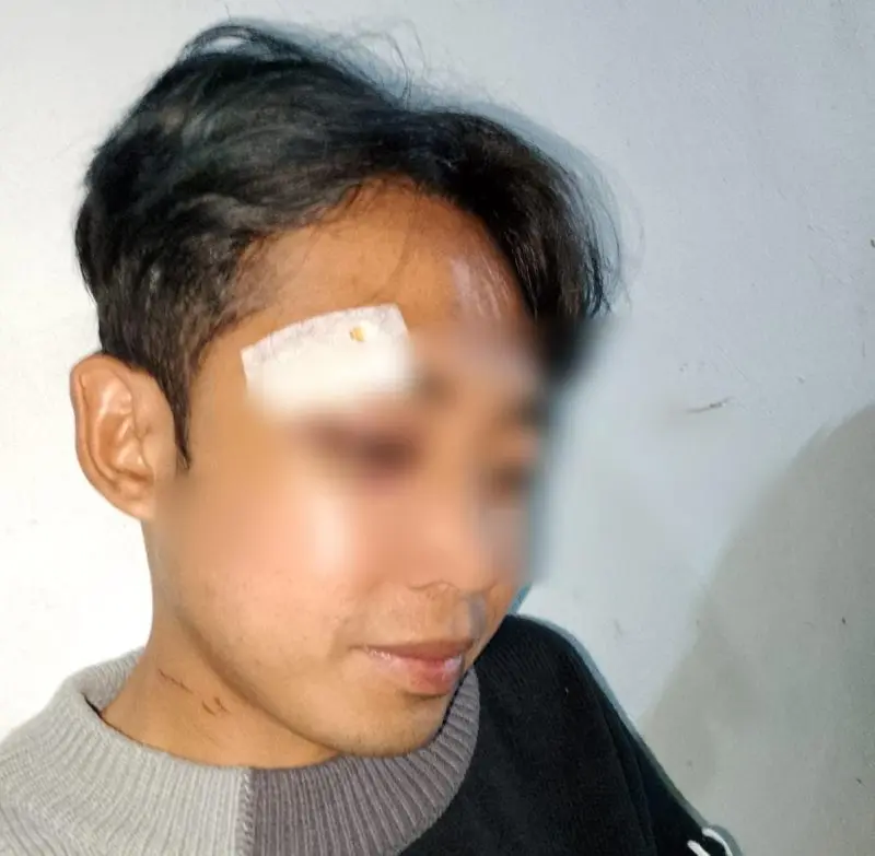 Korban pengeroyokan di Desa Campaka, Kecamatan Pasongsongan, Sumenep