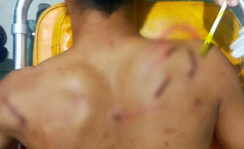 Ilustrasi pembacokan celurit di Pamekasan akibat dugaan motif asmara