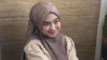 Ria Ricis Akui Jalani Operasi Hidung, Sebut Demi Kesehatan Pernapasan