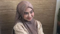 Penampilan terbaru Ria Ricis usai menjalani operasi rinoplasti untuk memperbaiki struktur hidung dan pernapasan