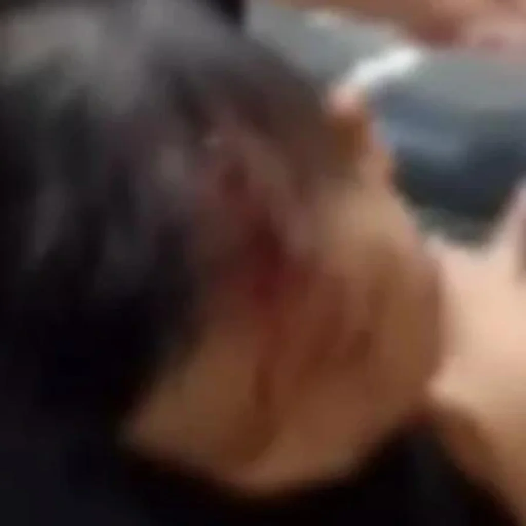 Balita 3 Tahun di Sampang Diserang Monyet, Polisi Cegah Warga Berburu 9 Balita diserang monyet di Sampang mengalami luka pada pipi kiri