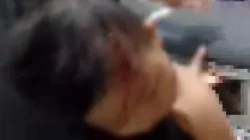 Balita 3 Tahun di Sampang Diserang Monyet, Polisi Cegah Warga Berburu 3 Balita diserang monyet di Sampang mengalami luka pada pipi kiri